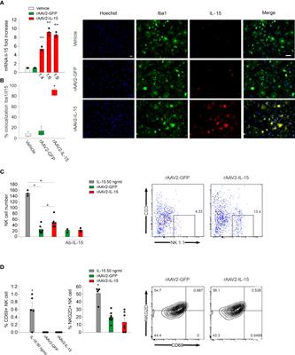 Enriched Environment Cues Suggest a New Strategy to Counteract Glioma: Engineered rAAV2-IL-15 Microglia Modulate the Tumor Microenvironment